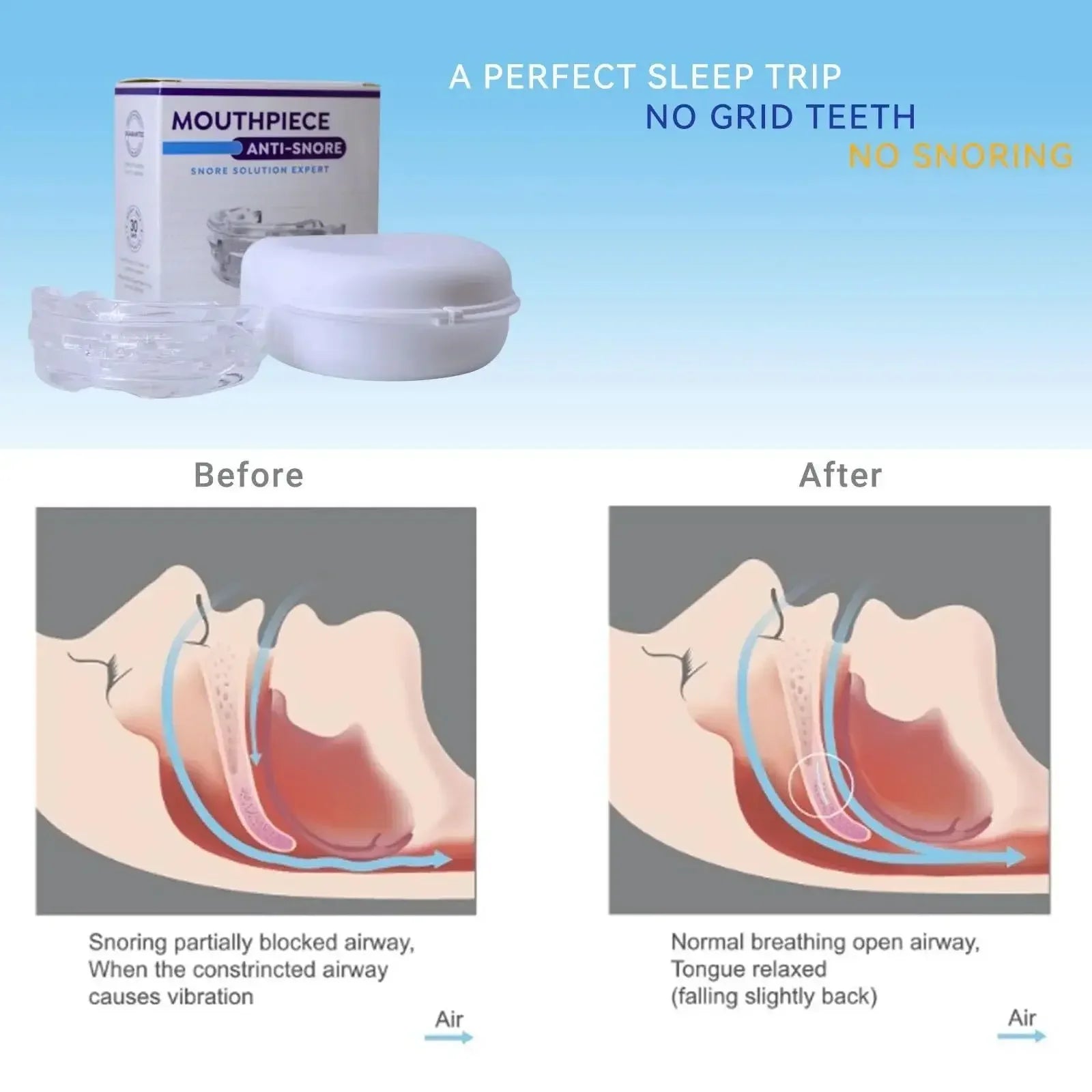 Adjustable Anti-Snoring Mouth Guard  Mouthpiece Sleeping Devices Bruxism Snoring Stopper Improve Sleep Mouthpiece